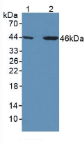 Polyclonal Antibody to Thyroxine Binding Globulin (TBG)