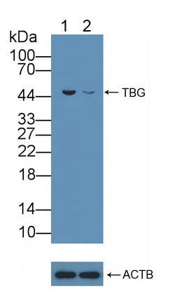 Polyclonal Antibody to Thyroxine Binding Globulin (TBG)