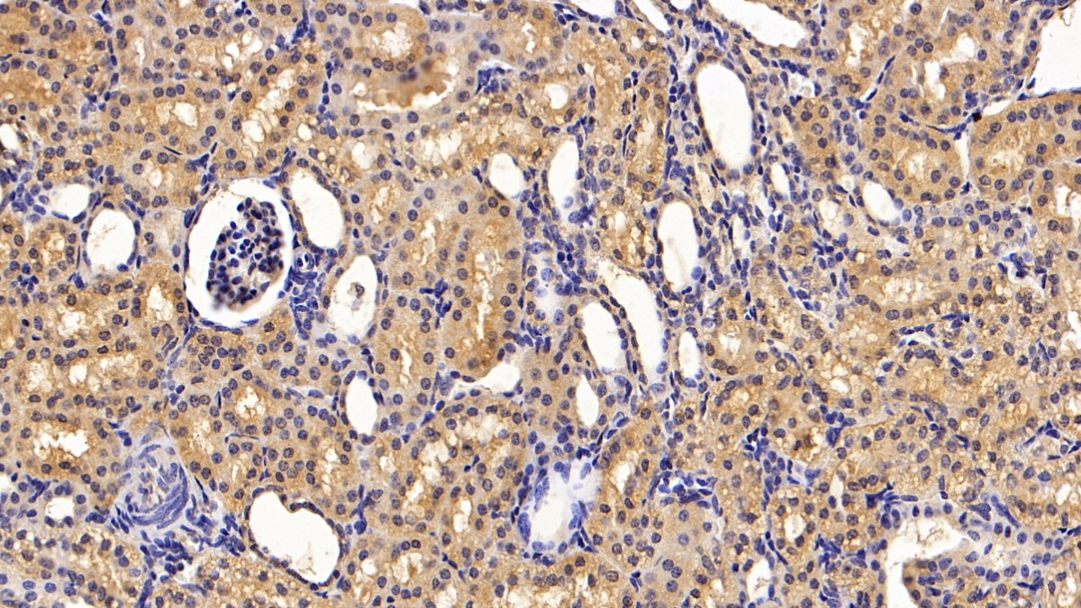 Polyclonal Antibody to Thyroxine Binding Globulin (TBG)