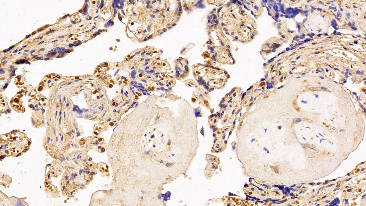 Polyclonal Antibody to Thyroxine Binding Globulin (TBG)