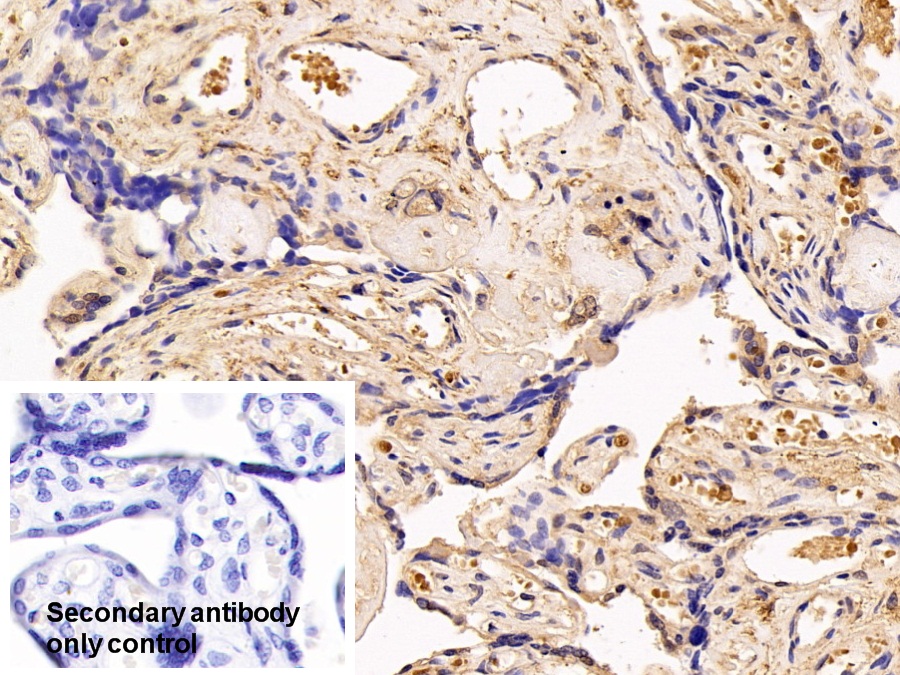 Polyclonal Antibody to Thyroxine Binding Globulin (TBG)