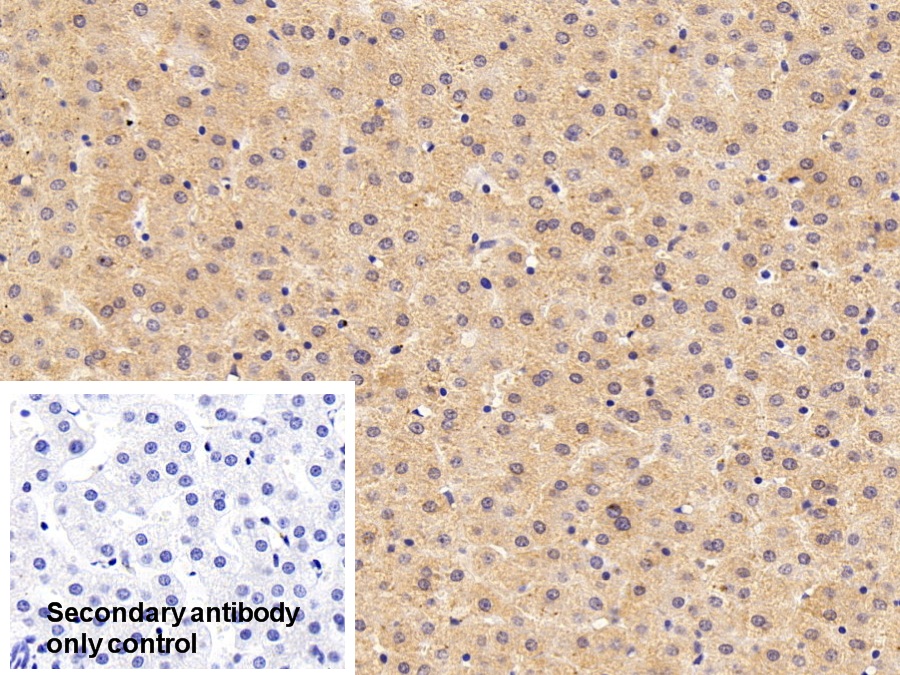 Polyclonal Antibody to Thyroxine Binding Globulin (TBG)