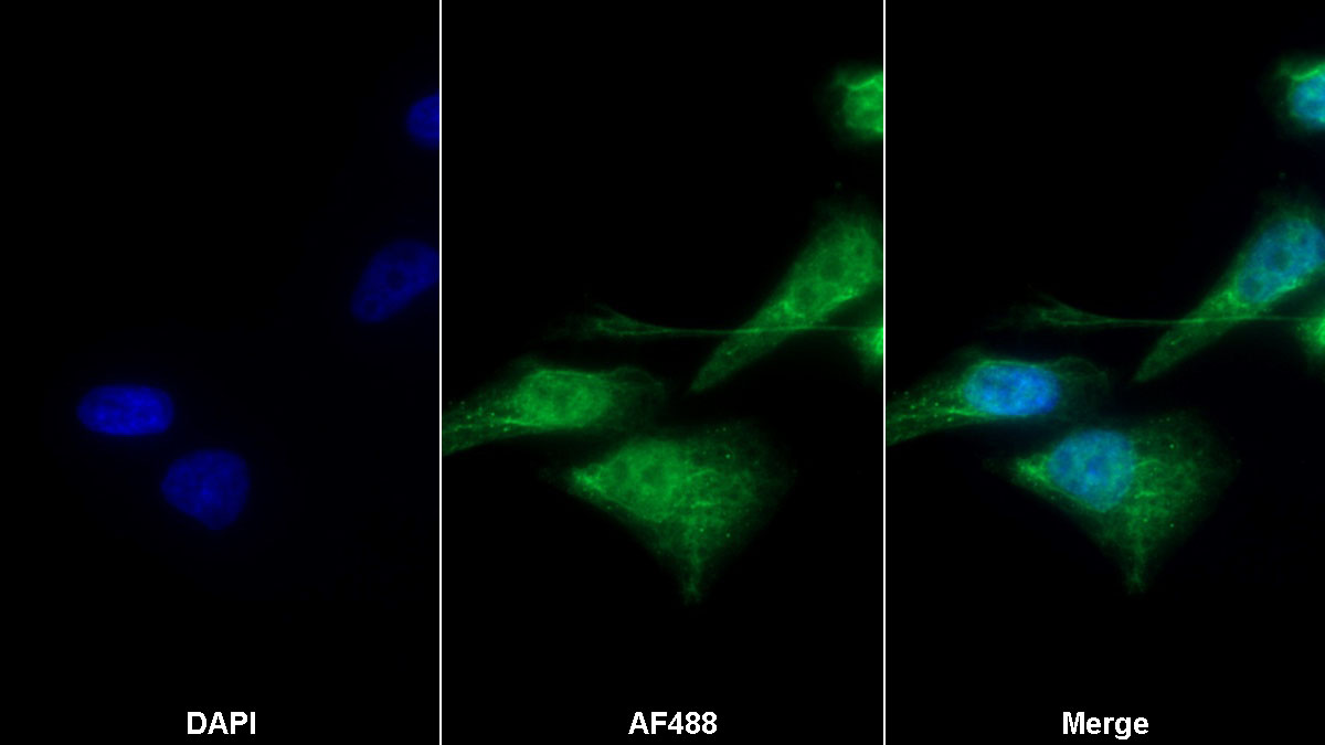 Polyclonal Antibody to Thyroxine Binding Globulin (TBG)