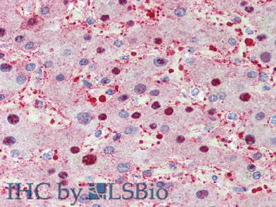 Polyclonal Antibody to Thyroxine Binding Globulin (TBG)