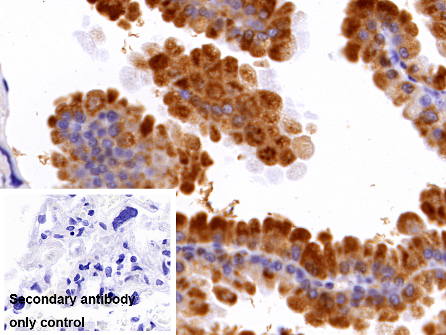 Polyclonal Antibody to Cathepsin L (CTSL)