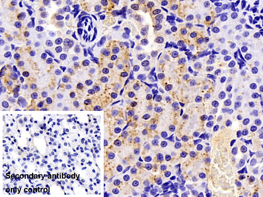 Polyclonal Antibody to Cathepsin L (CTSL)