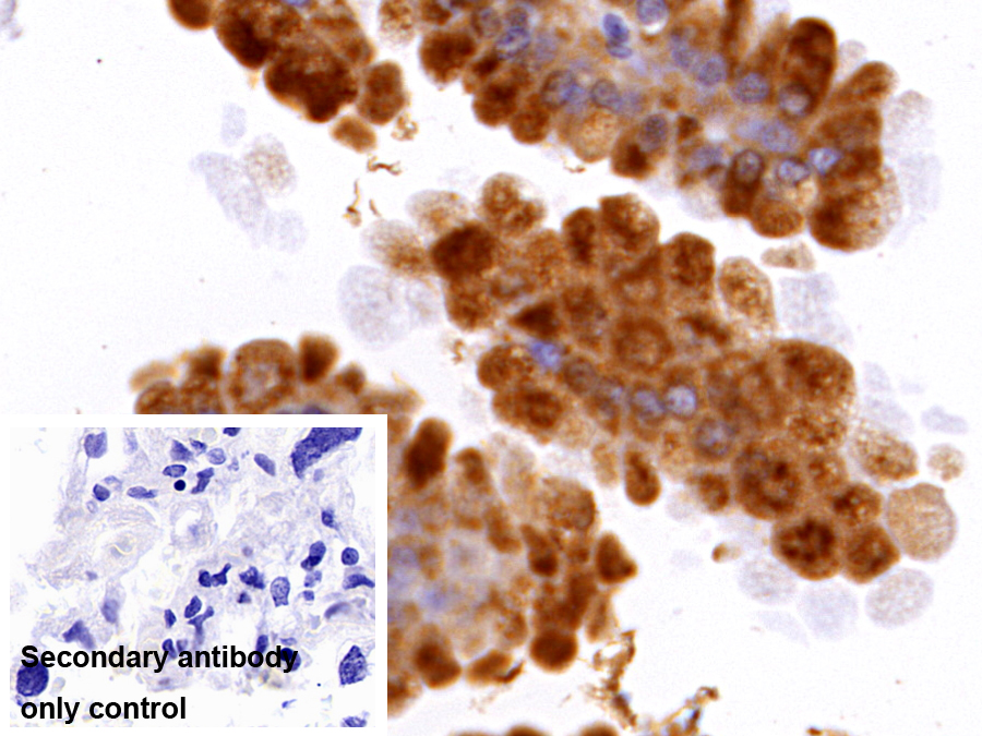 Polyclonal Antibody to Cathepsin L (CTSL)