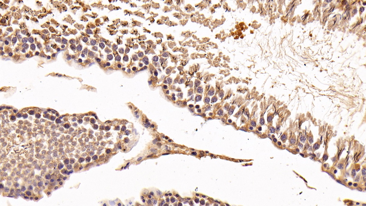 Polyclonal Antibody to Galectin 8 (GAL8)