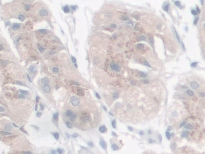 Polyclonal Antibody to Galectin 9 (GAL9)