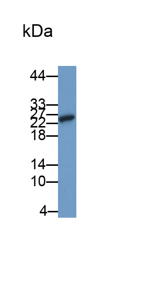 Polyclonal Antibody to Galectin 9 (GAL9)