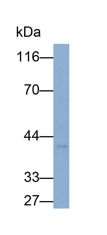 Polyclonal Antibody to Galectin 9 (GAL9)