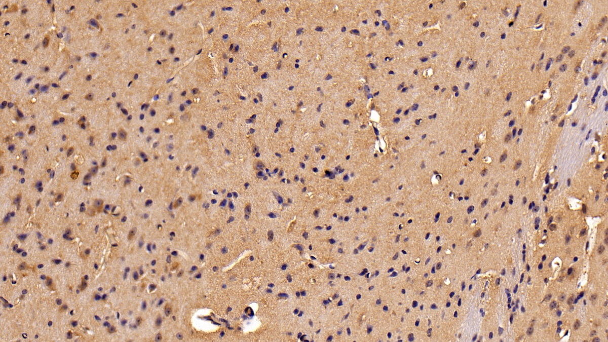 Polyclonal Antibody to Galectin 9 (GAL9)