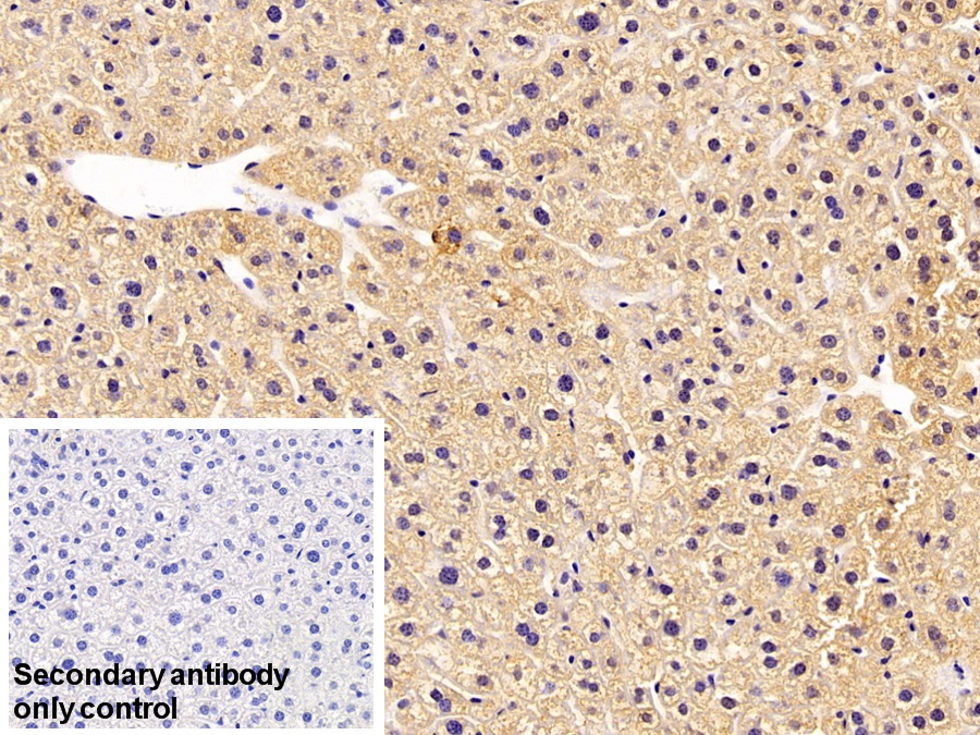 Polyclonal Antibody to Galectin 9 (GAL9)