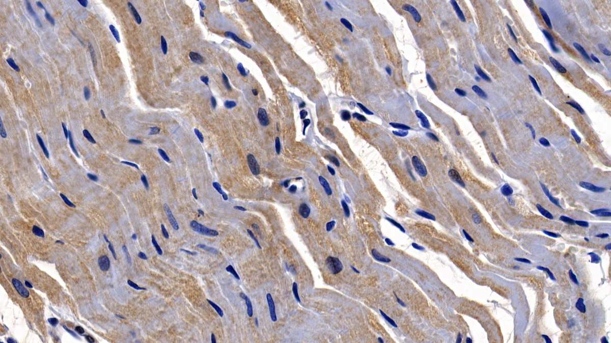 Polyclonal Antibody to Galectin 9 (GAL9)