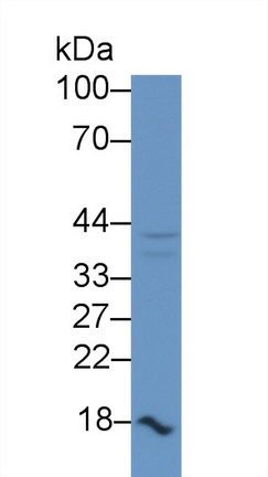 Polyclonal Antibody to Galectin 9 (GAL9)