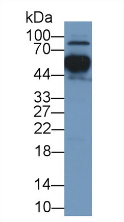 Polyclonal Antibody to Apolipoprotein H (APOH)