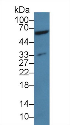 Polyclonal Antibody to Apolipoprotein H (APOH)