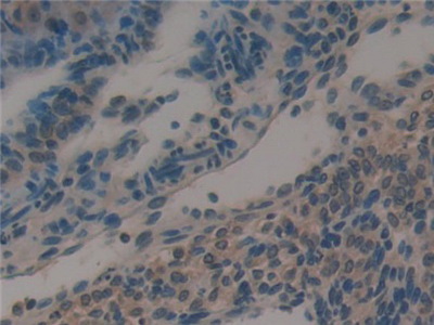 Polyclonal Antibody to Galectin 6 (GAL6)