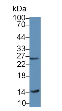 Polyclonal Antibody to Galectin 1 (GAL1)