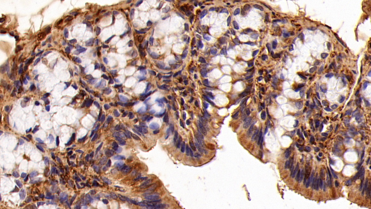 Polyclonal Antibody to Galectin 1 (GAL1)