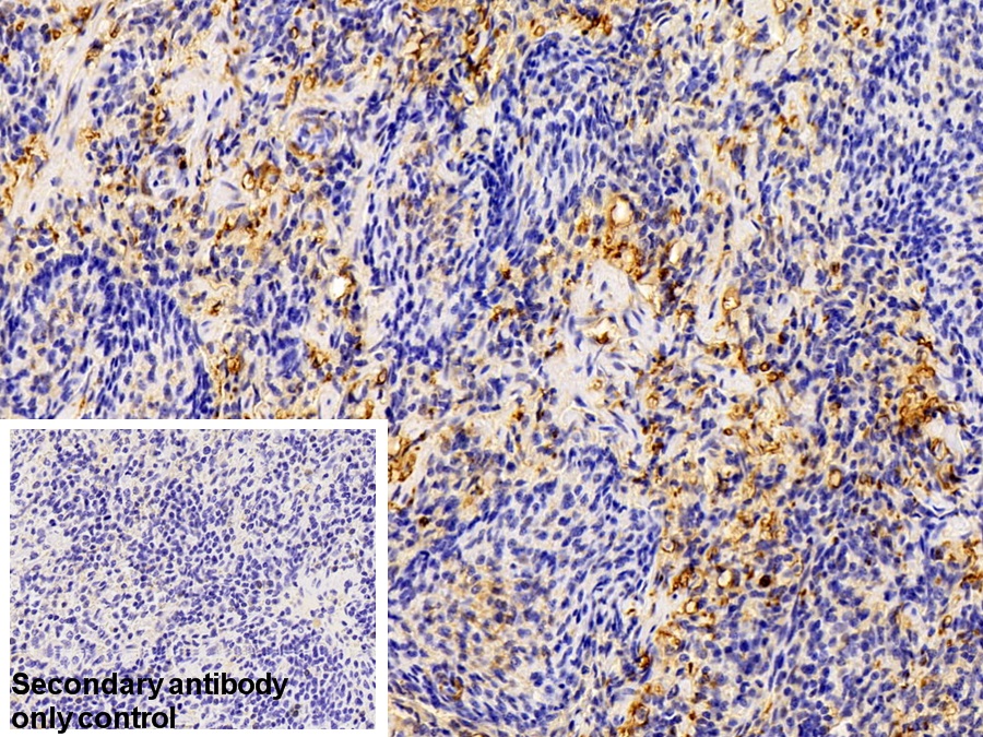 Polyclonal Antibody to Galectin 1 (GAL1)