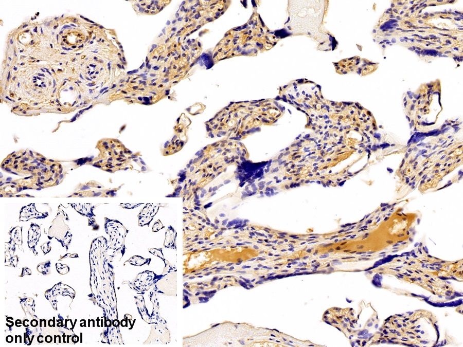 Polyclonal Antibody to Galectin 1 (GAL1)