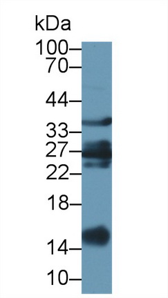 Polyclonal Antibody to Galectin 1 (GAL1)