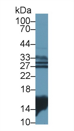 Polyclonal Antibody to Galectin 1 (GAL1)