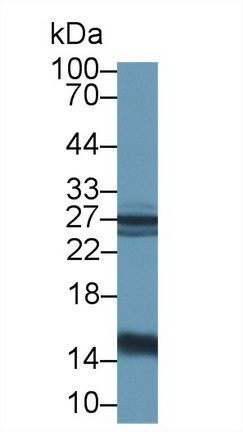 Polyclonal Antibody to Galectin 1 (GAL1)