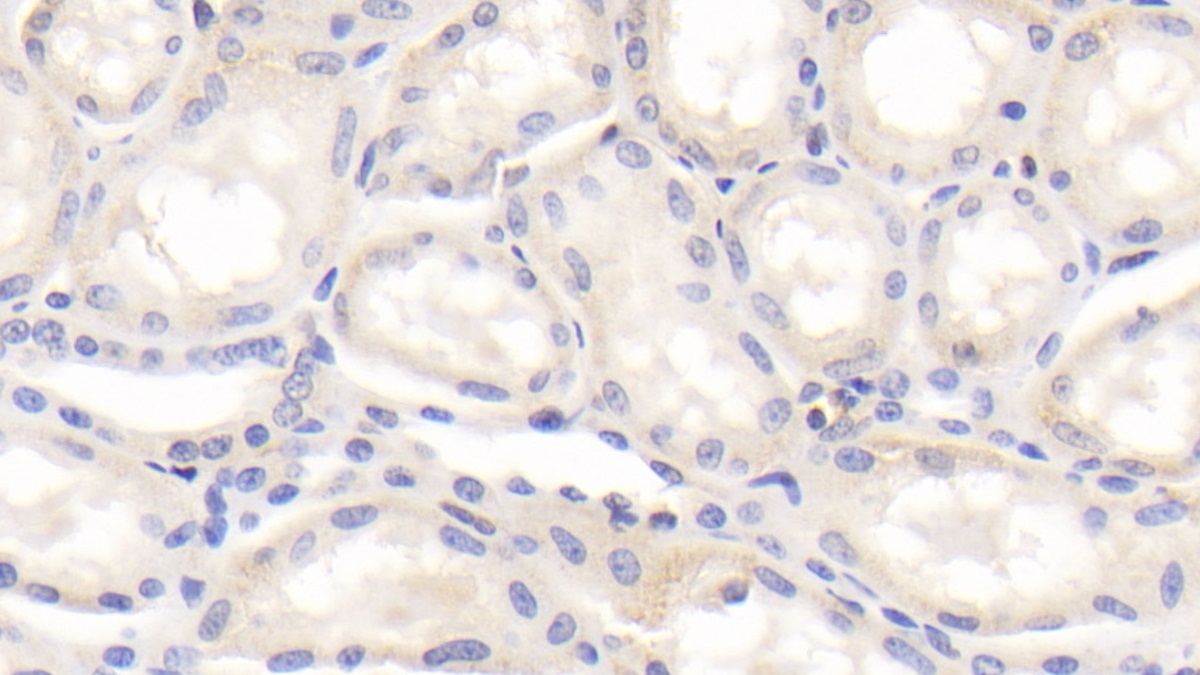 Polyclonal Antibody to Galectin 1 (GAL1)