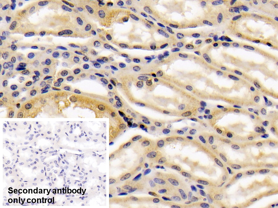 Polyclonal Antibody to Galectin 1 (GAL1)