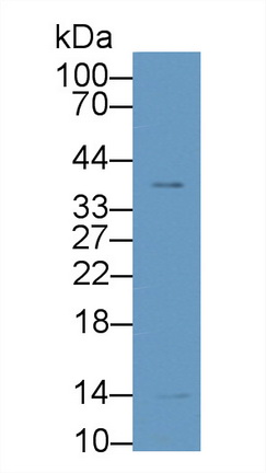 Polyclonal Antibody to Galectin 1 (GAL1)