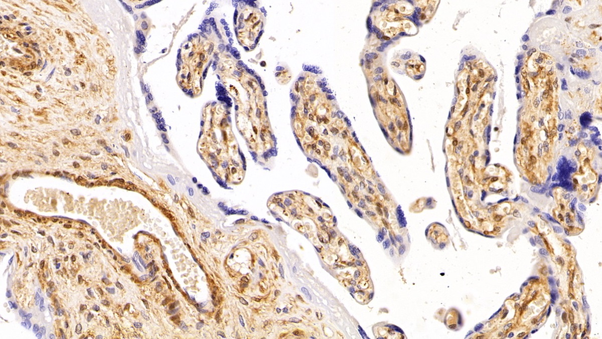 Polyclonal Antibody to Galectin 1 (GAL1)