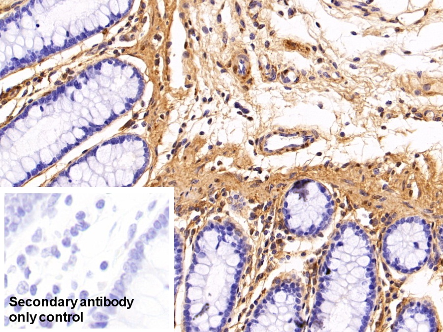 Polyclonal Antibody to Galectin 1 (GAL1)