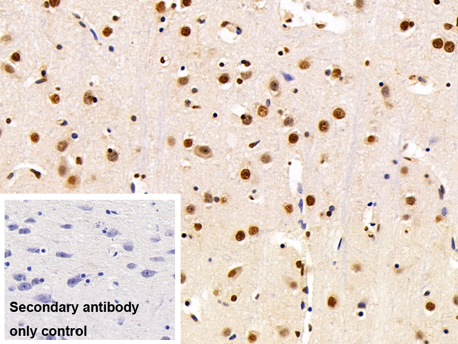 Polyclonal Antibody to Heterogeneous Nuclear Ribonucleoprotein A2/B1 (HNRPA2B1)