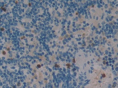 Polyclonal Antibody to Sp100 Nuclear Antigen (Sp100)