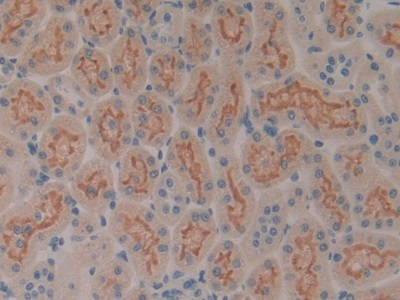 Polyclonal Antibody to Sp100 Nuclear Antigen (Sp100)