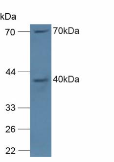 Polyclonal Antibody to Neutrophil Cytosolic Factor 4 (NCF4)