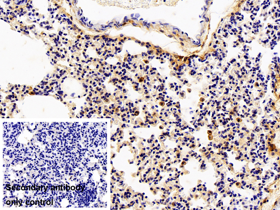 Polyclonal Antibody to Neutrophil Cytosolic Factor 4 (NCF4)