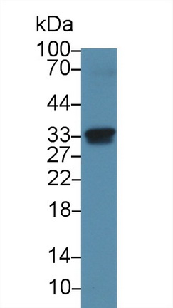 Polyclonal Antibody to Nitric Oxide Synthase Interacting Protein (NOSIP)