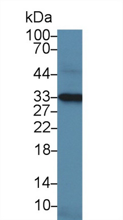 Polyclonal Antibody to Nitric Oxide Synthase Interacting Protein (NOSIP)