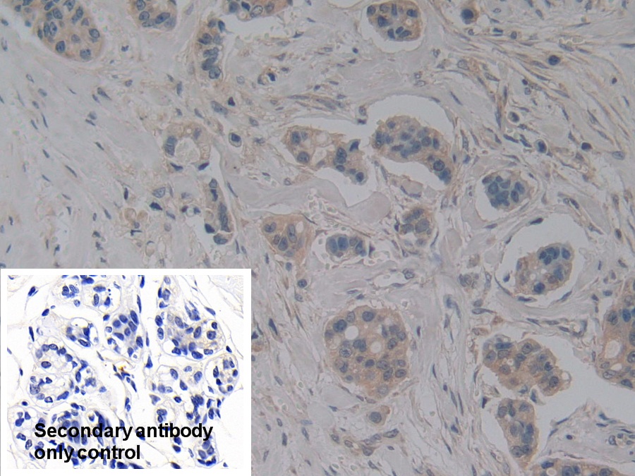 Polyclonal Antibody to Nitric Oxide Synthase Interacting Protein (NOSIP)