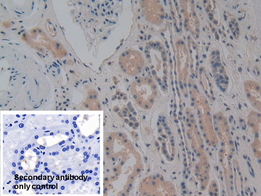 Polyclonal Antibody to Nitric Oxide Synthase Interacting Protein (NOSIP)