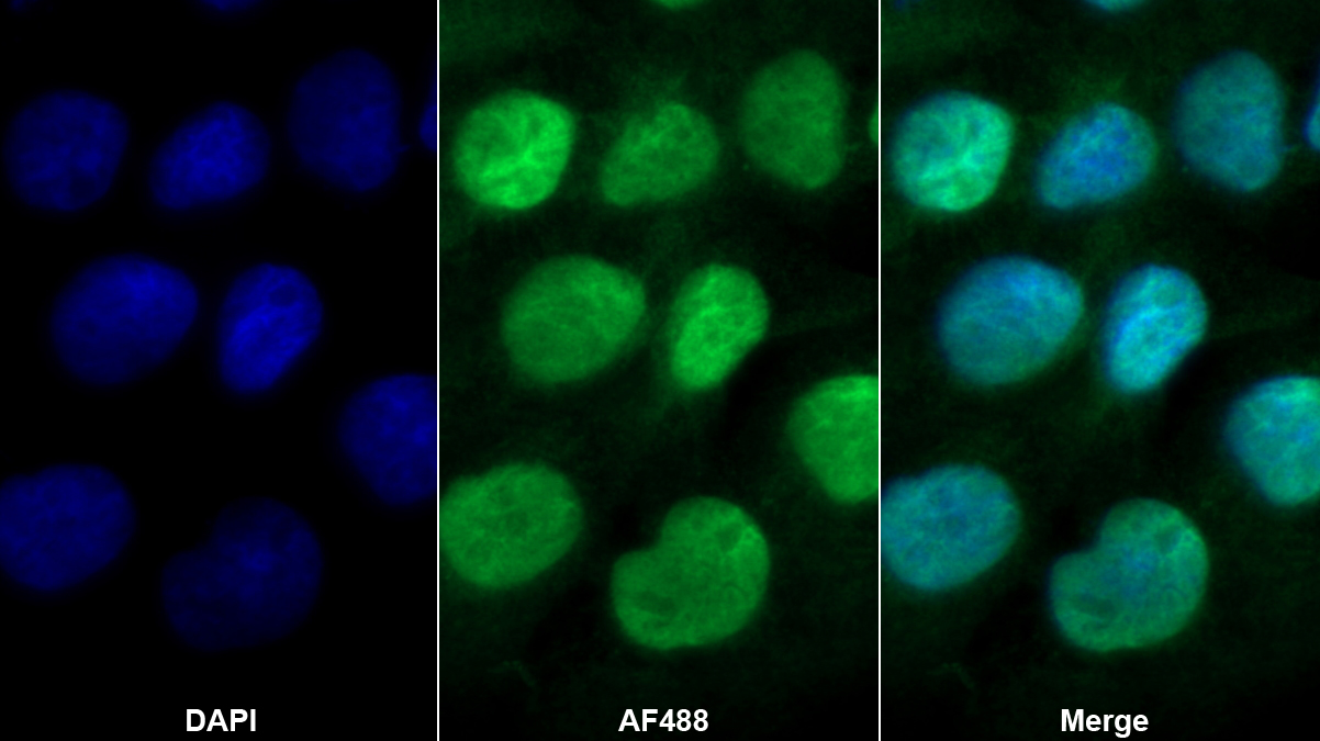 Polyclonal Antibody to Nitric Oxide Synthase Interacting Protein (NOSIP)