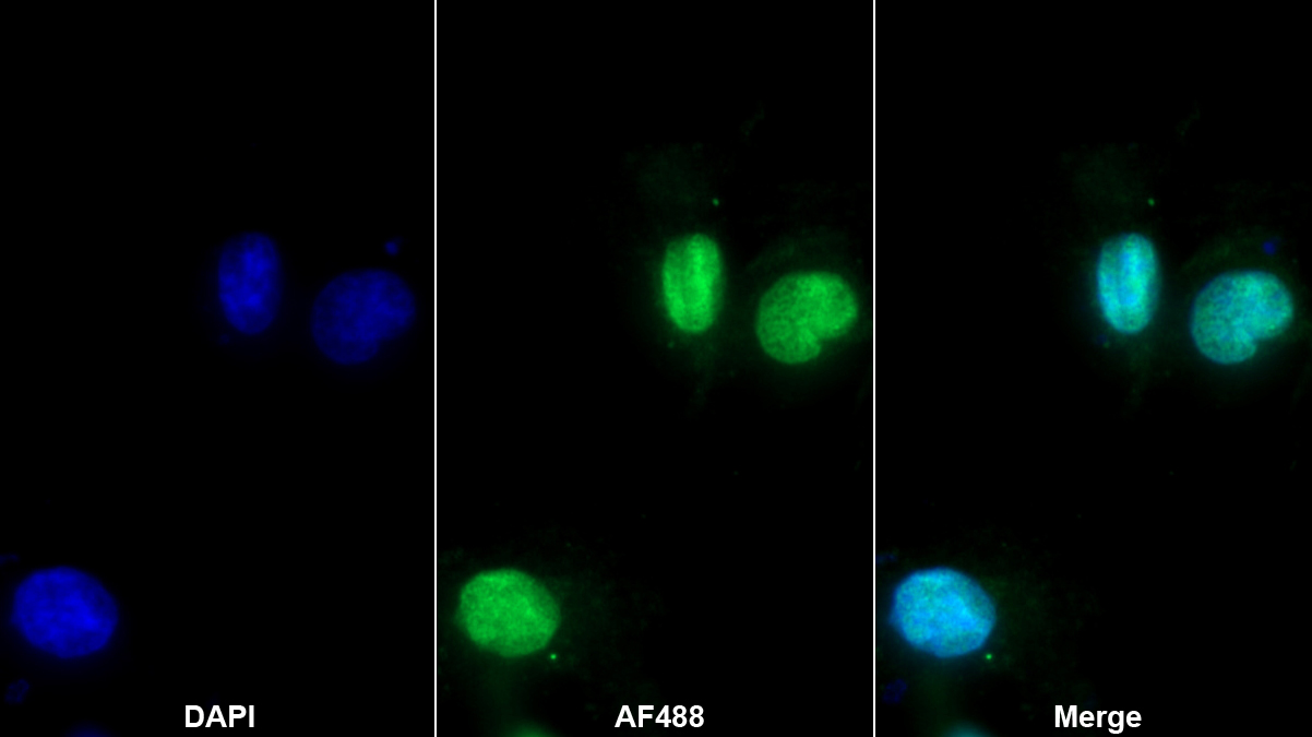 Polyclonal Antibody to Nitric Oxide Synthase Interacting Protein (NOSIP)