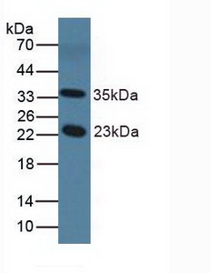 Polyclonal Antibody to Nitric Oxide Synthase 1 Adaptor Protein (NOS1AP)