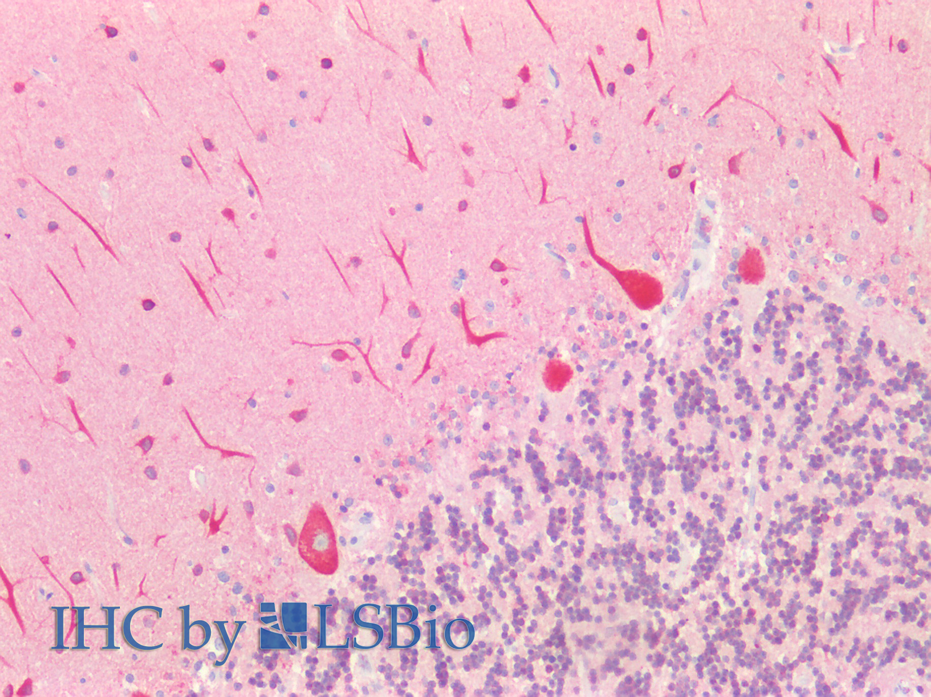 Polyclonal Antibody to Microtubule Associated Protein 1A (MAP1A)