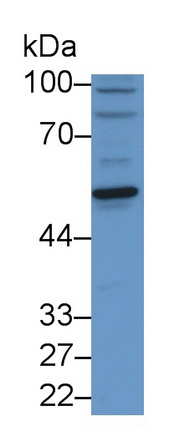 Polyclonal Antibody to Cathepsin A (CTSA)