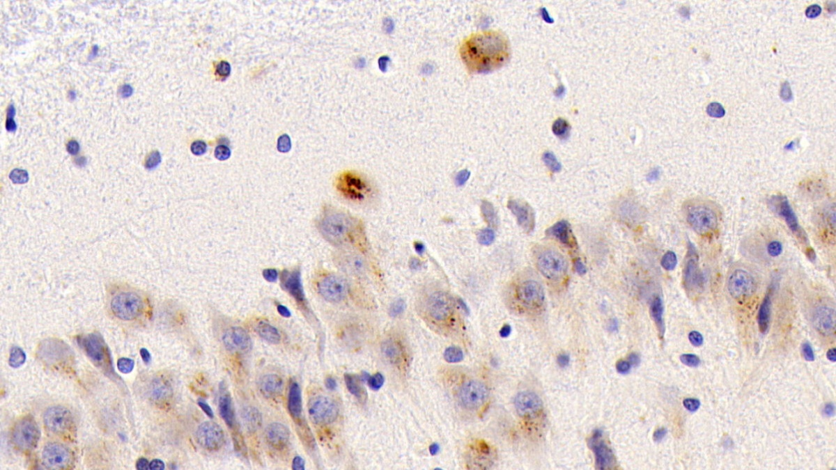 Polyclonal Antibody to Cathepsin A (CTSA)