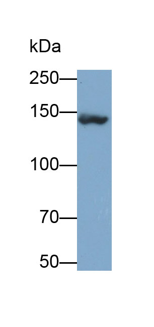 Polyclonal Antibody to Collagen Type I Alpha 1 (COL1a1)